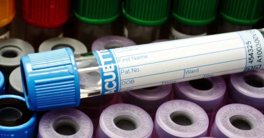 A sample tube with a white label; the label needs good flexibility to allow it to remain in place around the narrow cylinder of the tube. 